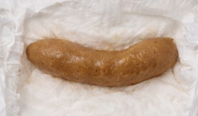 Stool sample 4